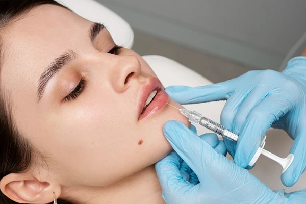 Primer plano de un médico aplicando un tratamiento labial con jeringa de uso médico.