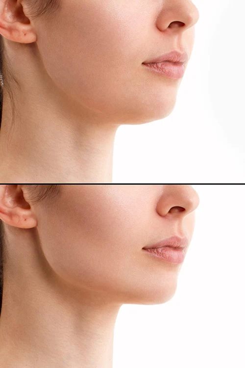 Médico evaluando el tabique nasal de una paciente durante una valoración estética.