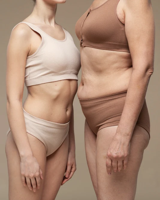 Dos mujeres de frente comparando la zona del abdomen antes de un tratamiento endoláser corporal