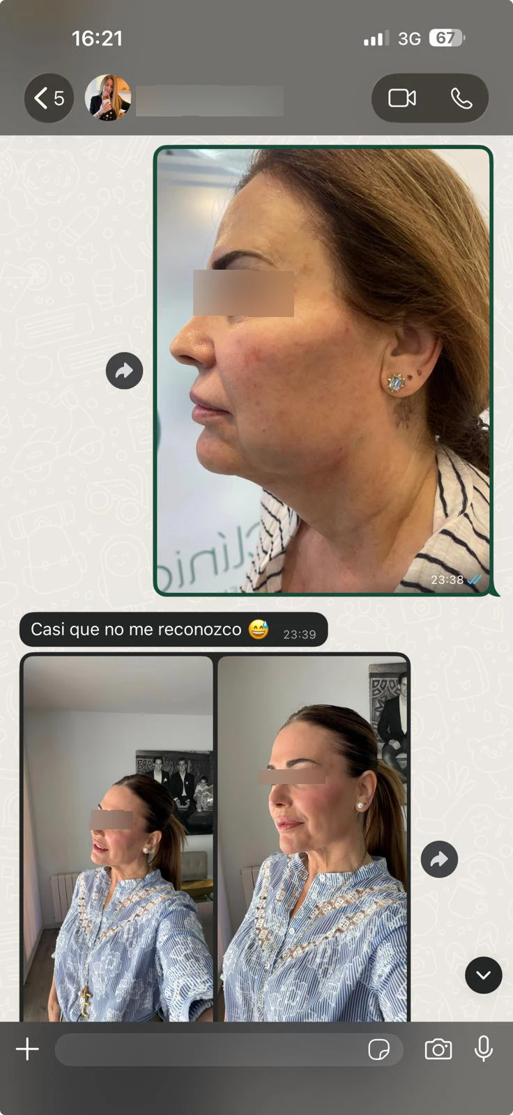Captura de WhatsApp de paciente comentando su resultado de endolifting facial: "casi que no me reconozco"