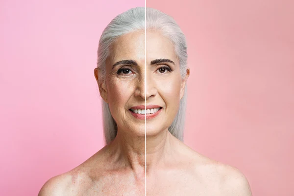 Tratamientos para Reafirmar el Rostro sin Cirugía: Guía Comparativa